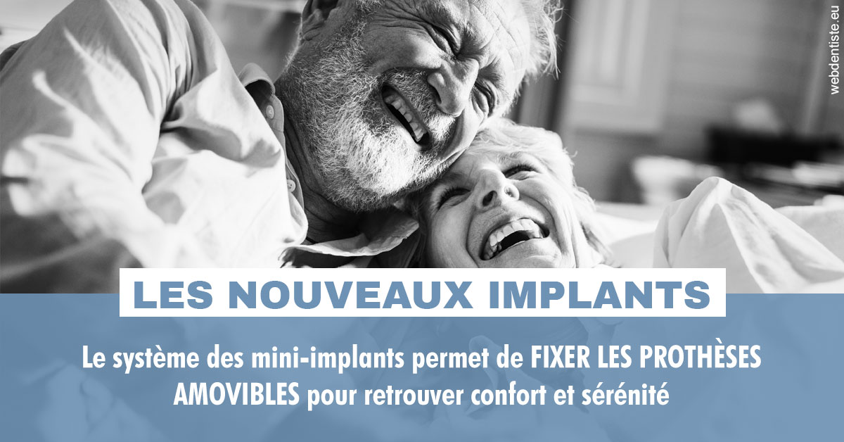 https://dr-azuelos-alain.chirurgiens-dentistes.fr/Les nouveaux implants 2