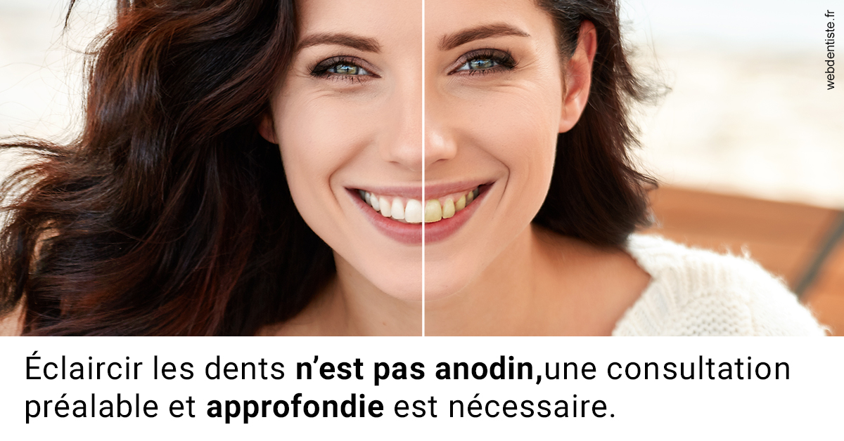 https://dr-azuelos-alain.chirurgiens-dentistes.fr/Le blanchiment 2