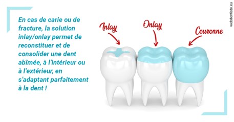 https://dr-azuelos-alain.chirurgiens-dentistes.fr/L'INLAY ou l'ONLAY