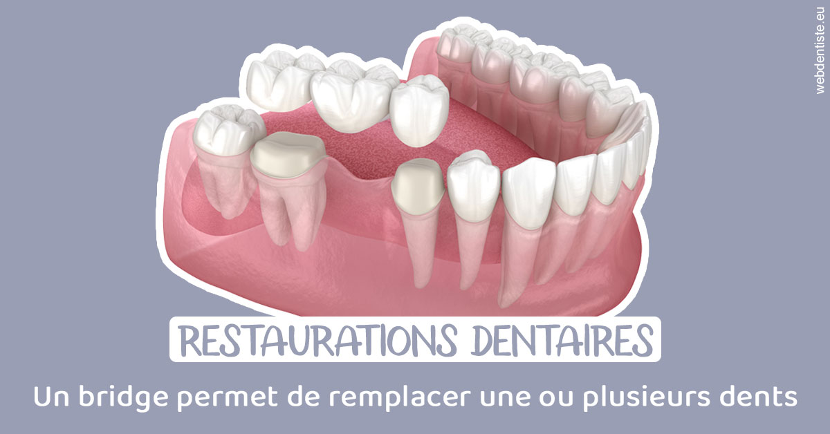 https://dr-azuelos-alain.chirurgiens-dentistes.fr/Bridge remplacer dents 1