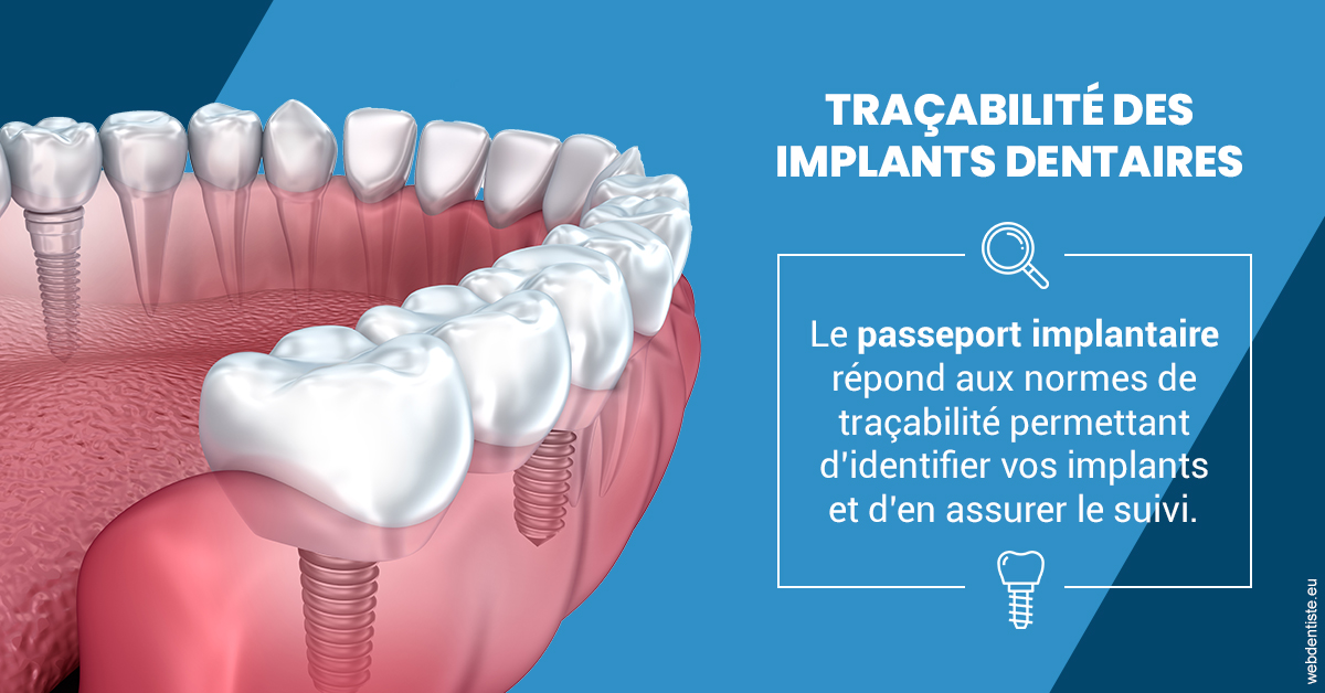https://dr-azuelos-alain.chirurgiens-dentistes.fr/T2 2023 - Traçabilité des implants 1