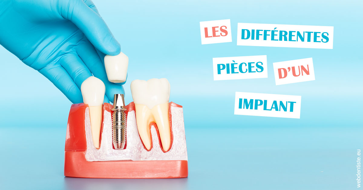 https://dr-azuelos-alain.chirurgiens-dentistes.fr/Les différentes pièces d’un implant 2