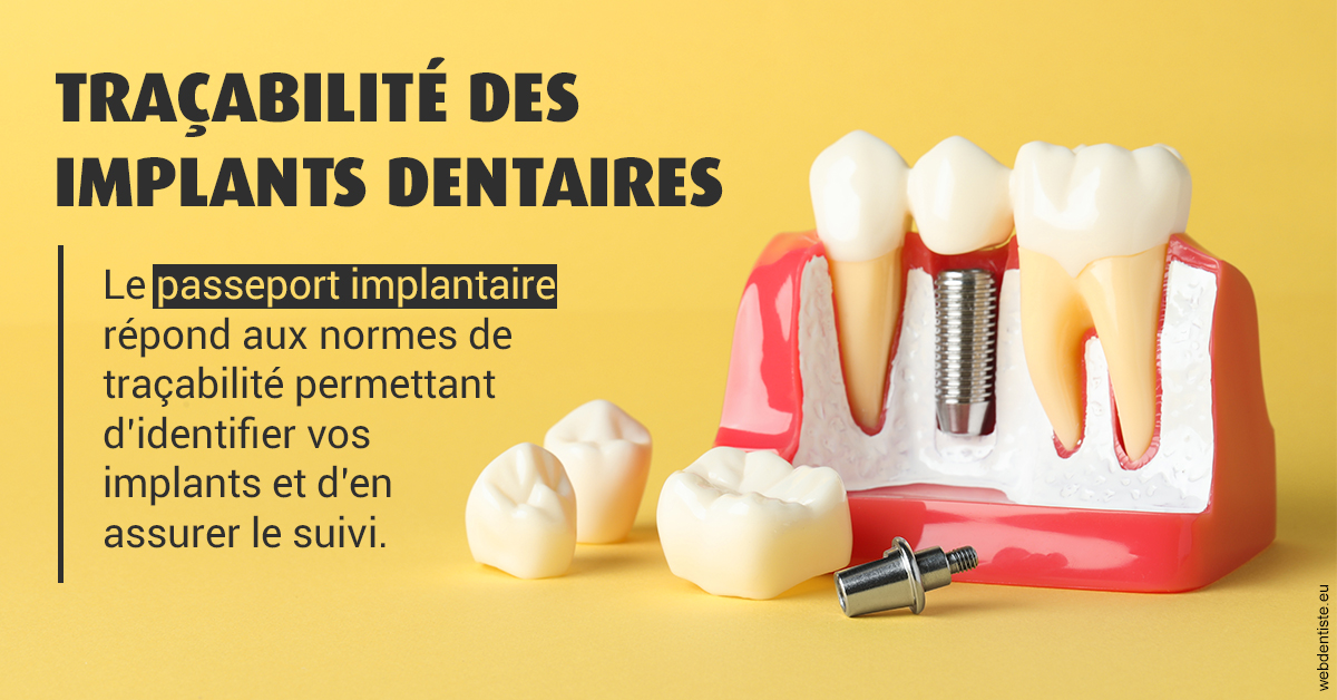https://dr-azuelos-alain.chirurgiens-dentistes.fr/T2 2023 - Traçabilité des implants 2