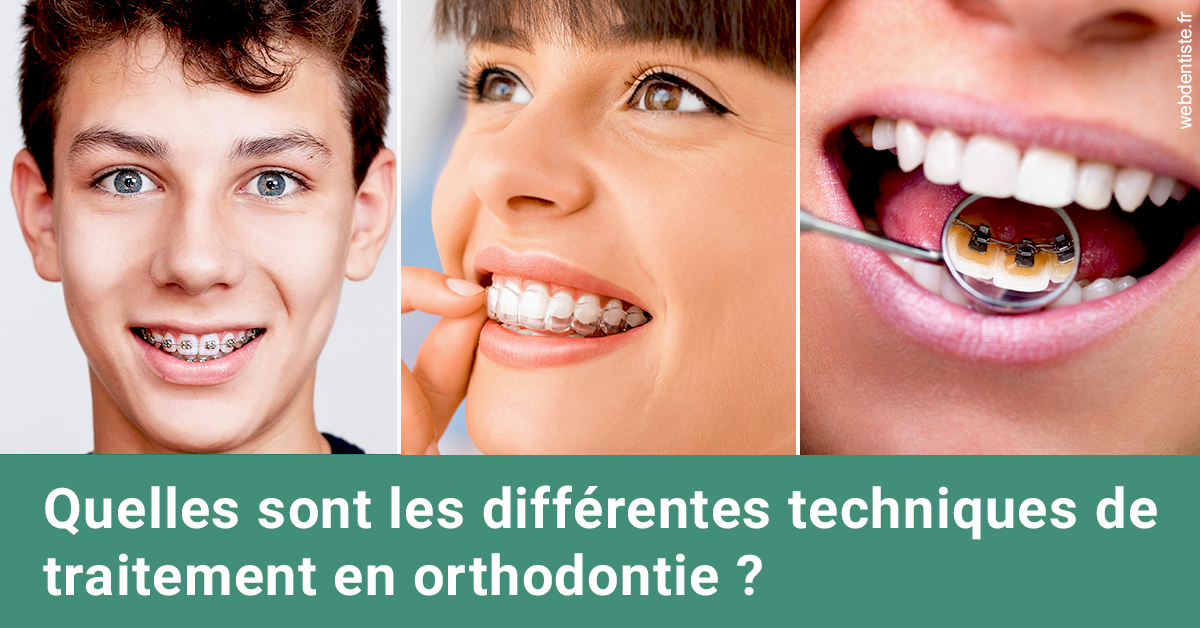 https://dr-azuelos-alain.chirurgiens-dentistes.fr/Les différentes techniques de traitement 2