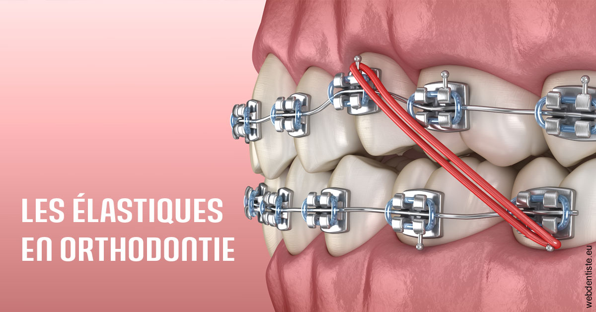 https://dr-azuelos-alain.chirurgiens-dentistes.fr/Elastiques orthodontie 2