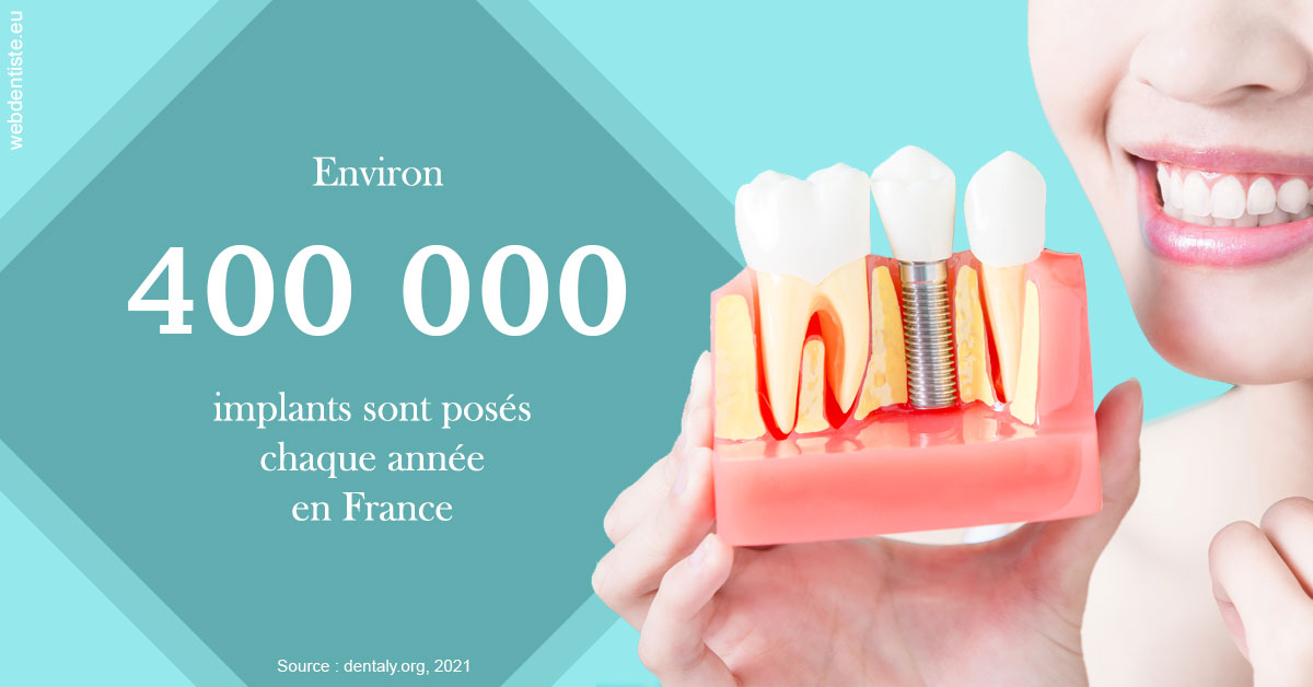 https://dr-azuelos-alain.chirurgiens-dentistes.fr/Pose d'implants en France 2